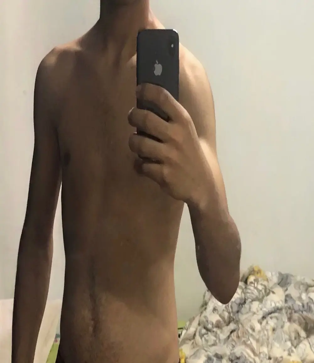 ALI96690